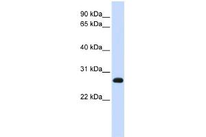 WB Suggested Anti-SNAP23 Antibody Titration:  0.