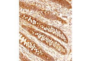 Immunohistochemical analysis of (ABIN653144 and ABIN2842716) on paraffin-embedded human appendix tissue was performed on the Leica®BOND RXm. (FCGR1B anticorps  (C-Term))