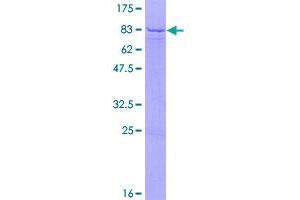 Image no. 1 for Protein Disulfide Isomerase Associated 5 (PDIA5) (AA 1-519) protein (GST tag) (ABIN1314537)