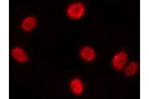 ABIN6275537 staining A549 by IF/ICC.