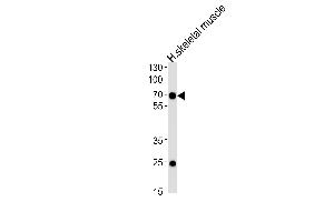 Western blot analysis of lysate from human skeletal muscle tissue lysate, using C4orf18 Antibody (Center) (ABIN657887 and ABIN2846841). (FAM198B anticorps  (AA 275-304))