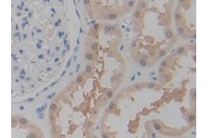 DAB staining on IHC-P; Samples: Human Kidney Tissue (P2RX7 anticorps  (AA 47-334))