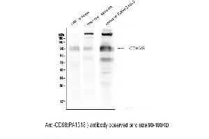 Anti-CD68 antibody, Western blotting Lane 1: Rat Spleen Tissue Lysate Lane 2: Mouse Spleen  Tissue Lysate Lane 3: Mouse RAW246. (CD68 anticorps  (Middle Region))