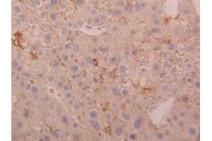 DAB staining on IHC-P; Samples: Human Liver Tissue