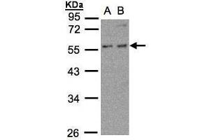WB Image Sample (30μg whole cell lysate) A:MOLT4 , B:Raji , 10% SDS PAGE antibody diluted at 1:500