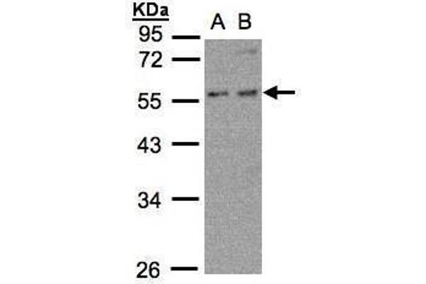 PFKFB4 anticorps