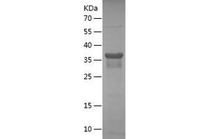 Western Blotting (WB) image for Cyclin A2 (CCNA2) (AA 144-264) protein (His-IF2DI Tag) (ABIN7122519)