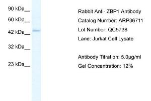 WB Suggested Anti-ZBP1 Antibody Titration: 5. (ZBP1 anticorps  (Middle Region))