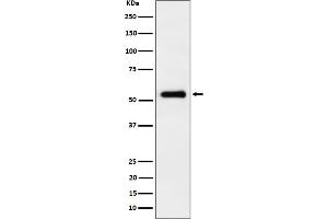 Western blot analysis of PRD expression in HepG2 cell lysate. (Recombinant Primary Retinal Dysplasia (PRD) anticorps)