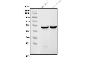 Western blot analysis of GFAP using anti-GFAP antibody (ABIN7602675).