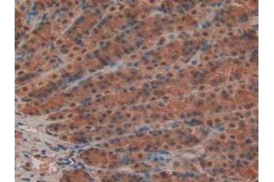 IHC-P analysis of Rat Stomach Tissue, with DAB staining. (MYH6 anticorps  (AA 419-666))