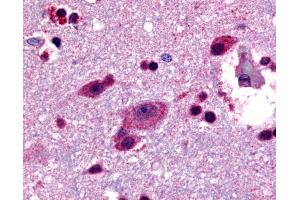 Anti-LGR4 antibody IHC of human brain, cortex.