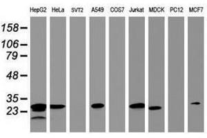 Image no. 3 for anti-Hydroxysteroid (17-Beta) Dehydrogenase 8 (HSD17B8) (AA 57-261) antibody (ABIN1491596) (HSD17B8 anticorps  (AA 57-261))