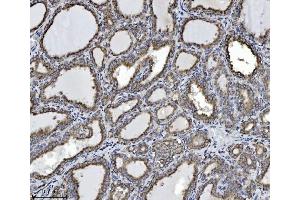 IHC analysis of SCA2/ATXN2 using anti-SCA2/ATXN2 antibody (ABIN7599900). (Ataxin 2 anticorps  (AA 1278-1313))
