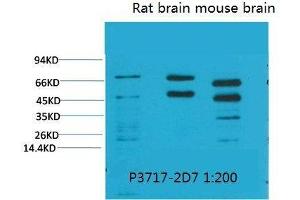 Western Blot (WB) analysis of 1) HeLa, 2)Rat Brain Tissue, 3) Mouse Brain Tissue with Phosphoserine Mouse Monoclonal Antibody diluted at 1:2000. (Phosphoserine anticorps  (phosphorylated))