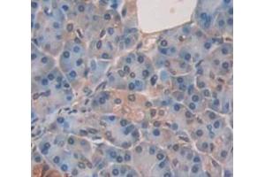 IHC-P analysis of Human Tissue, with DAB staining. (Dystrobrevin beta anticorps  (AA 1-249))