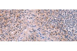 Immunohistochemistry of paraffin-embedded Human tonsil tissue using ITIH4 Polyclonal Antibody at dilution of 1:50(x200) (ITIH4 anticorps)