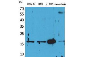 Western Blot (WB) analysis of 22RV-1, H460, U87, Mouse Brain cells using Apelin Polyclonal Antibody. (Apelin anticorps  (C-Term))