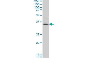 Western Blotting (WB) image for anti-PDZ Binding Kinase (PBK) (AA 1-110) antibody (ABIN599273) (PBK anticorps  (AA 1-110))