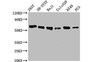 Western Blot Positive WB detected in: 293T whole cell lysate, SH-SY5Y whole cell lysate, Raji whole cell lysate, Colo320 whole cell lysate, A549 whole cell lysate, PC3 whole cell lysate All lanes: FTO antibody at 0. (Recombinant FTO anticorps)