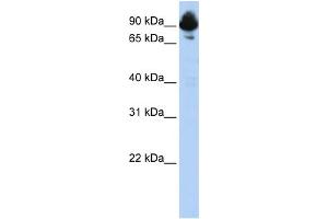 Host:  Rabbit  Target Name:  RGS3  Sample Type:  HepG2 lysates  Antibody Dilution:  1.
