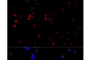 Immunofluorescence analysis of PC-12 cells using TBP Polyclonal Antibody at dilution of 1:100 (40x lens). (TBP anticorps)