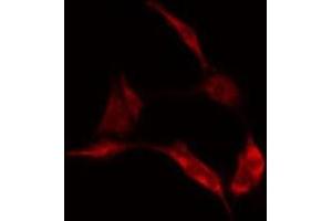 ABIN6278151 staining  Hela cells by IF/ICC. (LGALS1/Galectin 1 anticorps)