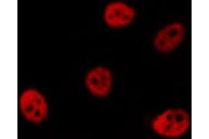 ABIN6277000 staining  Hela cells by IF/ICC.