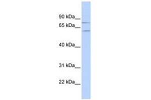 Image no. 1 for anti-Protein Inhibitor of Activated STAT, 1 (PIAS1) (N-Term) antibody (ABIN6742834) (PIAS1 anticorps  (N-Term))