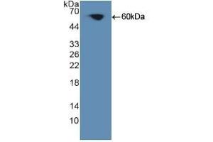 Detection of Recombinant PKCq, Human using Polyclonal Antibody to Protein Kinase C Theta (PKCq)