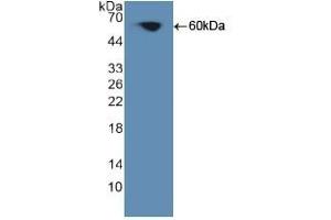 Detection of Recombinant PKCq, Human using Polyclonal Antibody to Protein Kinase C Theta (PKCq) (PKC theta anticorps  (AA 380-634))