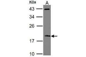 WB Image Sample (30 ug of whole cell lysate) A: Raji 12% SDS PAGE ADP-ribosylation factor 3 antibody antibody diluted at 1:1000 (ARF3 anticorps)