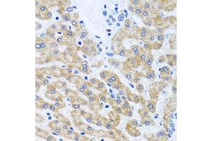 Immunohistochemistry of paraffin-embedded human liver using SCO1 antibody at dilution of 1:100 (x40 lens). (SCO1 anticorps)