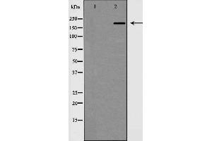 anti-Microtubule-Associated Protein 2 (MAP2) (N-Term) antibody