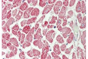 Rabbit Anti-Rps12 antibody Catalog Number: ARP51260 Formalin Fixed Paraffin Embedded Tissue: Human Heart Primary antibody Concentration: 1:100 Secondary Antibody: Donkey anti-Rabbit-Cy3 Secondary Antibody Concentration: 1:200 Magnification: 20x Exposure Time: 0.