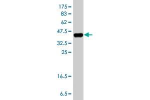 Western Blot detection against Immunogen (38. (CALCRL anticorps  (AA 23-132))