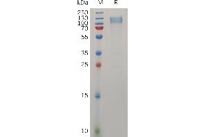 Human RET Protein, His Tag on SDS-PAGE under reducing condition.