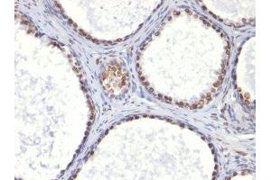 Image no. 1 for anti-Androgen Receptor (AR) (AA 299-315) antibody (ABIN6156150) (Androgen Receptor anticorps  (AA 299-315))