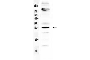 Western blot analysis of SRY using anti-SRY antibody . (SRY anticorps  (Middle Region))