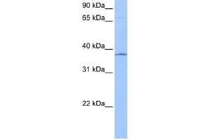 WB Suggested Anti-SPRY2 Antibody Titration:  0. (SPRY2 anticorps  (N-Term))