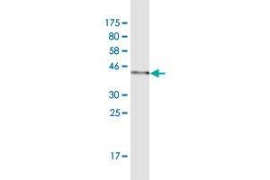 Western Blot detection against Immunogen (42. (HDDC3 anticorps  (AA 1-140))