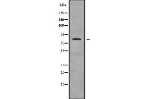 Western blot analysis of TRIM35 using HuvEc whole cell lysates (TRIM35 anticorps  (N-Term))
