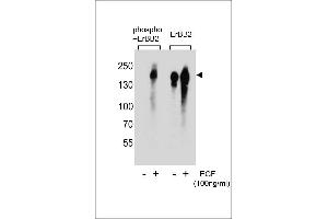 Western blot analysis of extracts from A431 cell,untreated or treated with EGF,using phospho-ERBB2- (left) or ErBB2 Antibody (right). (ErbB2/Her2 anticorps  (pTyr1005))
