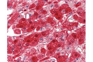 Anti-RDX / Radixin antibody IHC staining of human adrenal.