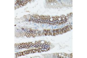 Immunohistochemistry of paraffin-embedded mouse colon using δ-Catenin/p120 Catenin Rabbit pAb (ABIN3022308, ABIN3022309, ABIN3022310, ABIN1512791 and ABIN6218725) at dilution of 1:50 (40x lens). (CTNND1 anticorps  (AA 573-832))