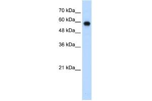 WB Suggested Anti-SMARCD2 Antibody Titration:  0. (SMARCD2 anticorps  (C-Term))