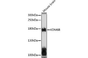 Western blot analysis of extracts of mouse brain, using KDM6B antibody (ABIN6131823, ABIN6142806, ABIN6142809 and ABIN6216507) at 1:1000 dilution. (Kdm6b anticorps  (AA 265-450))