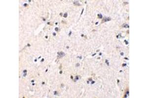 Immunohistochemistry of GFR alpha 1 in human brain tissue with GFR alpha 1 antibody at 1 μg/ml.