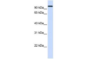 HSPA4 antibody used at 1 ug/ml to detect target protein. (HSPA4 anticorps  (Middle Region))