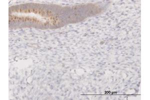 Immunoperoxidase of monoclonal antibody to C13orf24 on formalin-fixed paraffin-embedded human endometrium.